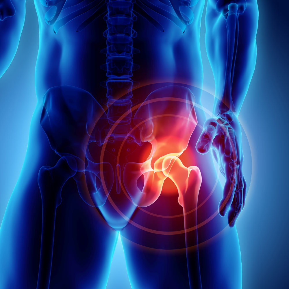 Can a Chiropractor Help With Hip Pain? Short Answer, Yes!