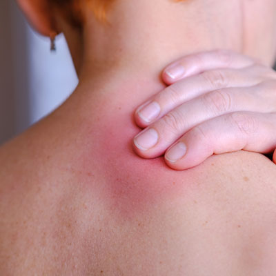 Neck Pain When Turning Head